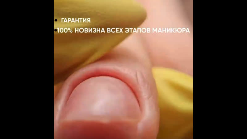 «анатомическая лысая фреза»
