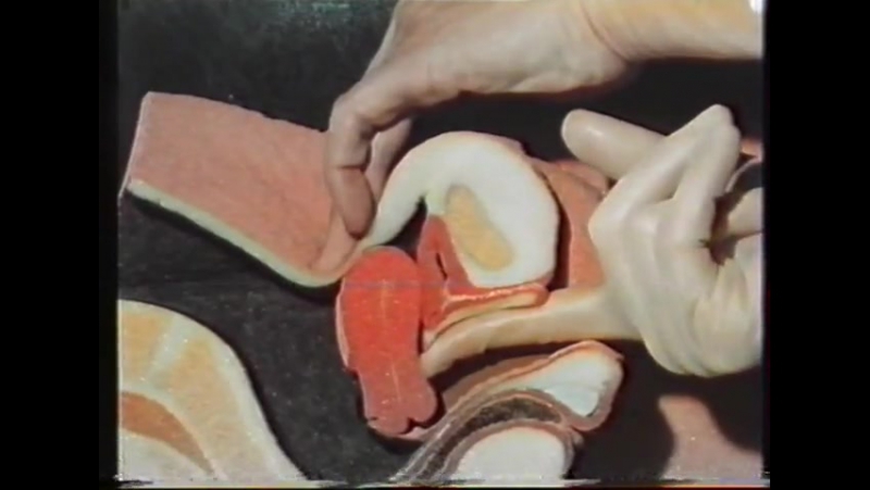 Уникальное видео гинекологического осмотра (чехословакия, 1987)
