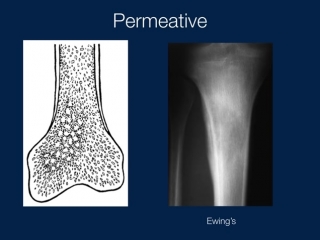 Bone lesions radiographic assessment part 1 (vumedi) by geoffrey m riley