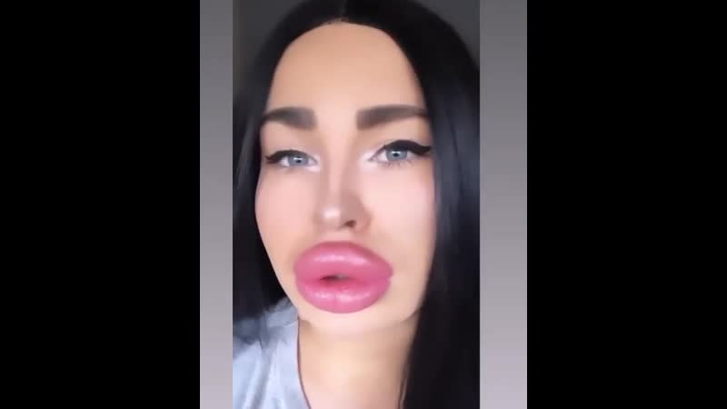 #lipsfiller #lipfiller #biglips #hugelips #siliconelips #пухлыегубы #силиконовыегыбы #большиегубы #филлер #filler #fillers #lips