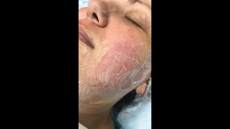 Кислородная маска