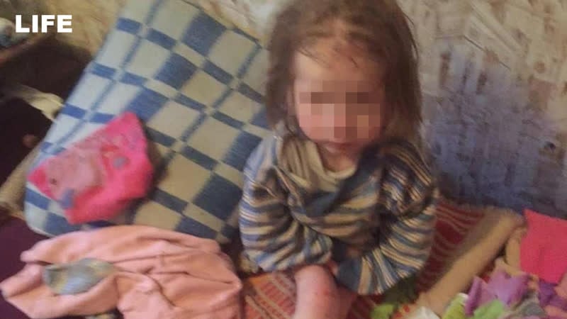 Из приёмной семьи в больницу истощённую девочку нашли под брянском