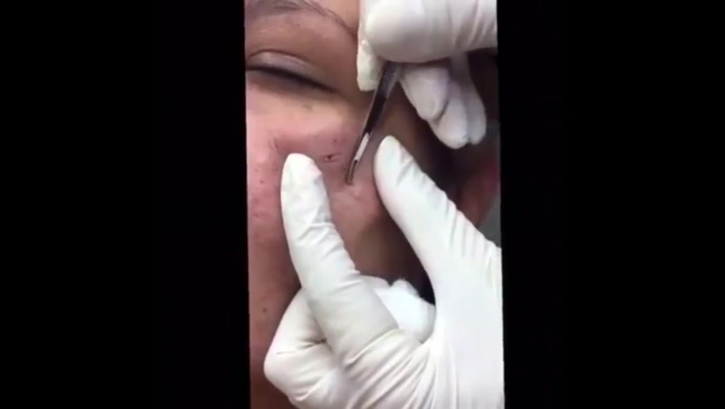 Давненько не давили как хорошо пошёл