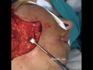 Проверка реакции нервных окончаний