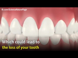Dentists use laser to treat gum disease and prevent tooth loss
