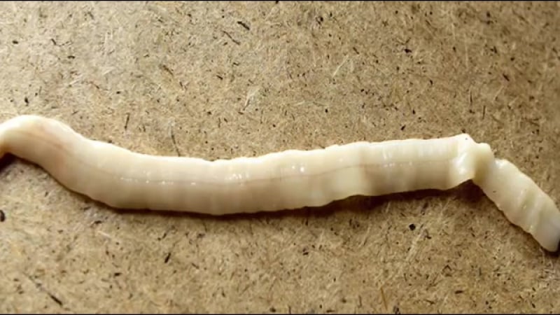 Топ 10 жуткие глисты и паразиты в организме человека