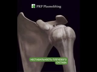 Видео от plasmolifting clinic | плазмотерапия | москва