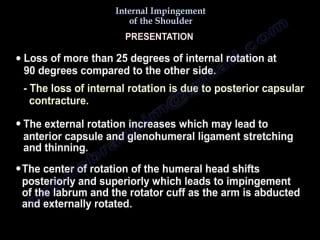 Internal impingement of the shoulder everything you need to know dr nabil eb