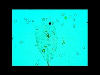 Euglena feeding under microsope