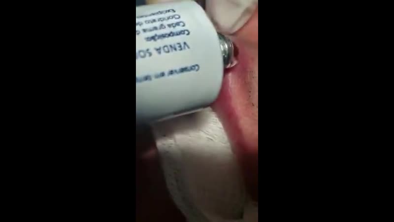 Извлечение паразита