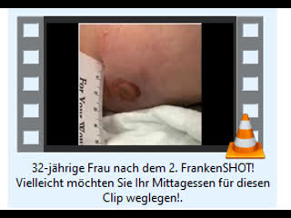 32 jährige frau nach dem 2 frankenshot! vielleicht möchten sie ihr mittagessen für diesen clip weglegen!