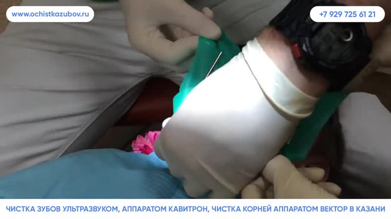 – ультразвуковая чистка зубов в казани