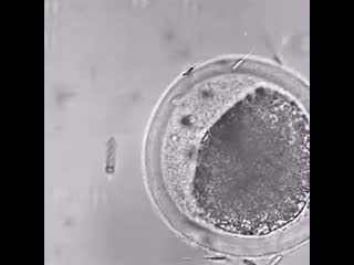 Spermbot delivering sperm to egg