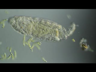 Bdelloid rotifer 200x dic