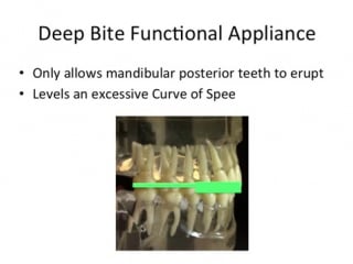 Orthodontic treatment pt 4 ортодонтия