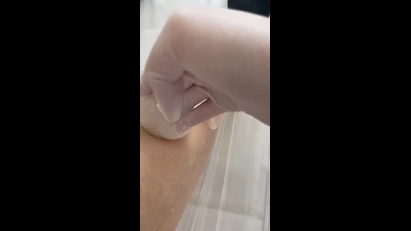 Шугаринг голени