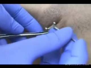 Piercing del triangolo