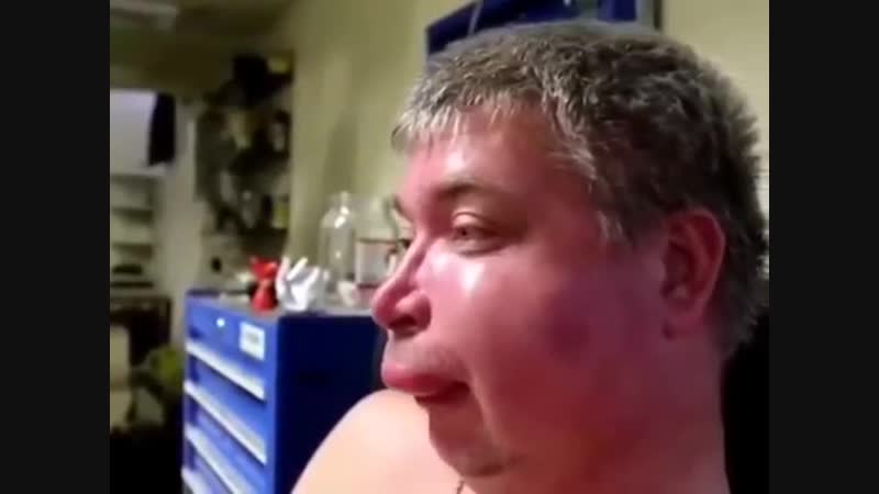 Мужика укусила оса и он сидит прикалывается