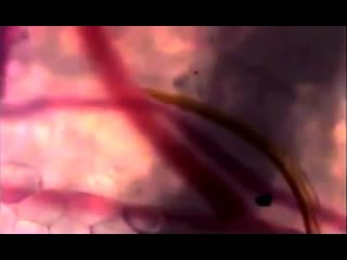 Укус комара под микроскопом