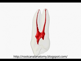 Maxillary first premolar prof marco versiani