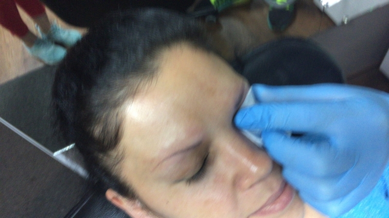 Удаляем татуаж бровей