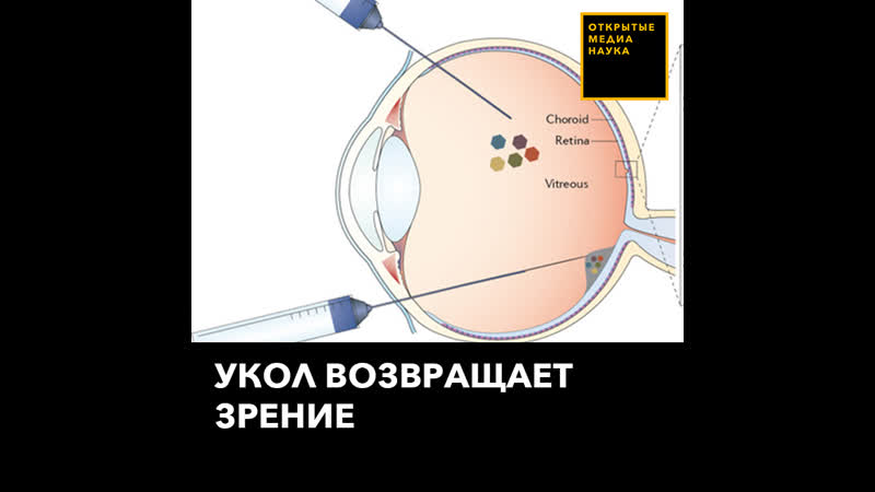 Укол возвращает зрение