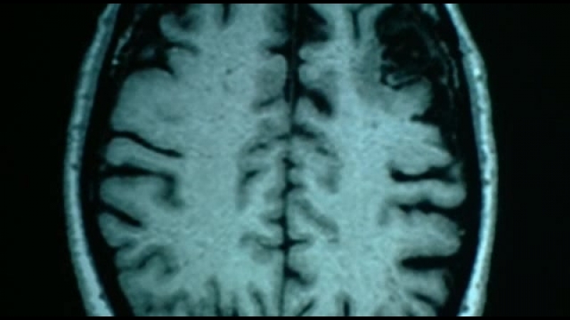 Bbc тайны мозга 4 я серия первый среди равных (brain story)