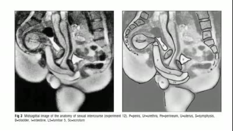 Секс в разрезе