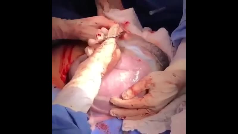 Мальчик родился в рубашке,