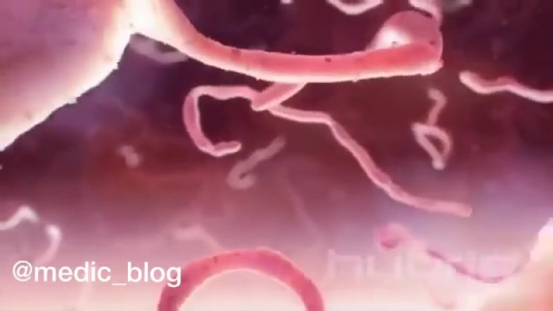 Немного инфы о вирусе эбола