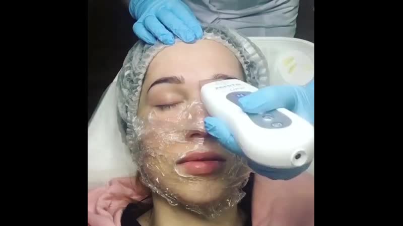 ♦ультразвуковая чистка лица♦
