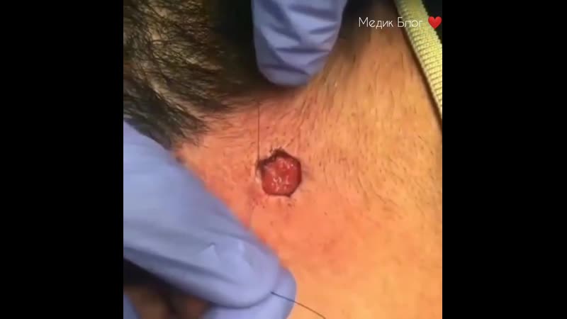 Вы знаете, как называется этот шов?