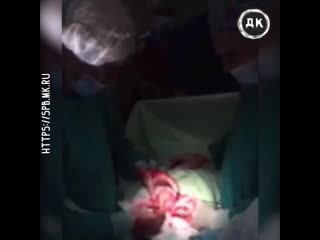 Вытащили огромный фаллос из задницы | дерзкий квадрат