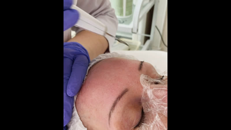 Ультразвуковая чистка лица