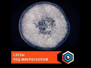 Слезы под микроскопом