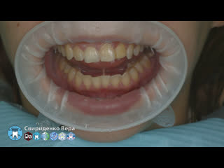 Professional oral hygiene dte pt 5 acteon kerr hawe dentsply (fhd multistream)