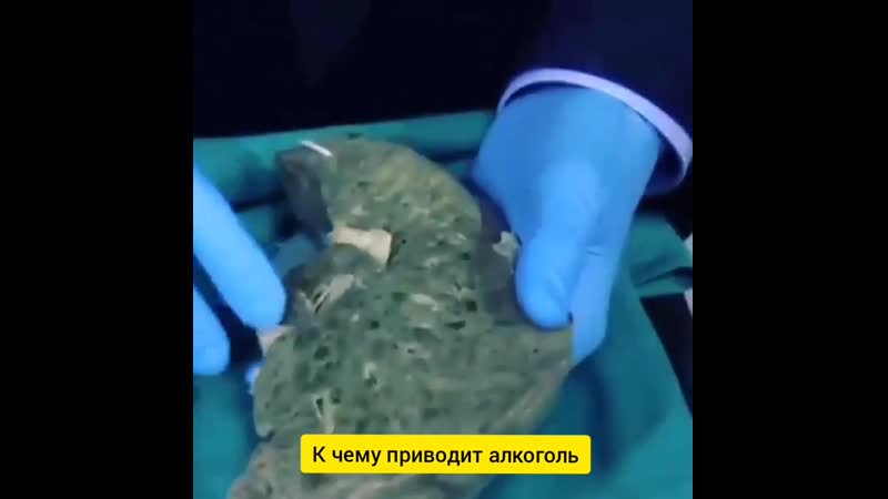 Последствия употребления алкоголя
