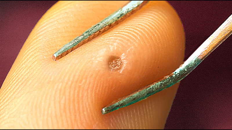 Самый красивый угорь под микроскопом!