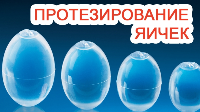 Протезирование яичек