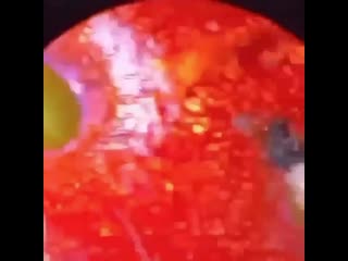 Вот почему нужно мыть ягоды