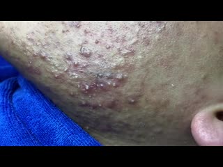 Ди линь, повтор