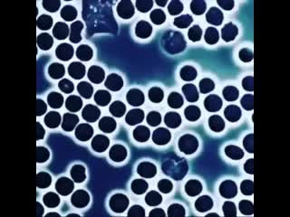 Иммунитет в действии