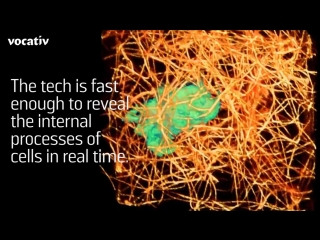 Lattice light sheet microscopy