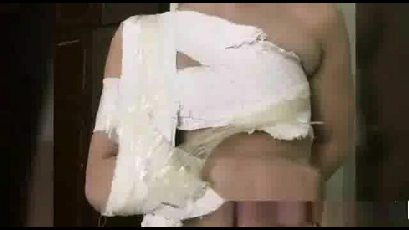 Хорошо наложили гипс