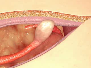 Ovario hystérectomy of cat (interactive) by saif tunisiano*