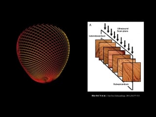 Using holography to reshape cardiology