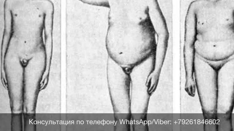 Мази, крема, спреи, таблетки для увеличения полового члена тотальный обман