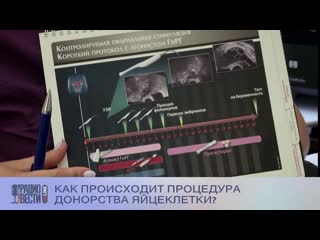 Как происходит процедура донорства яйцеклетки