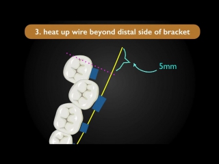 Errors in clinical practice ортодонтия