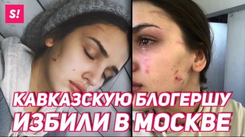 Блогера мадину басаеву избили за каазскую внешность